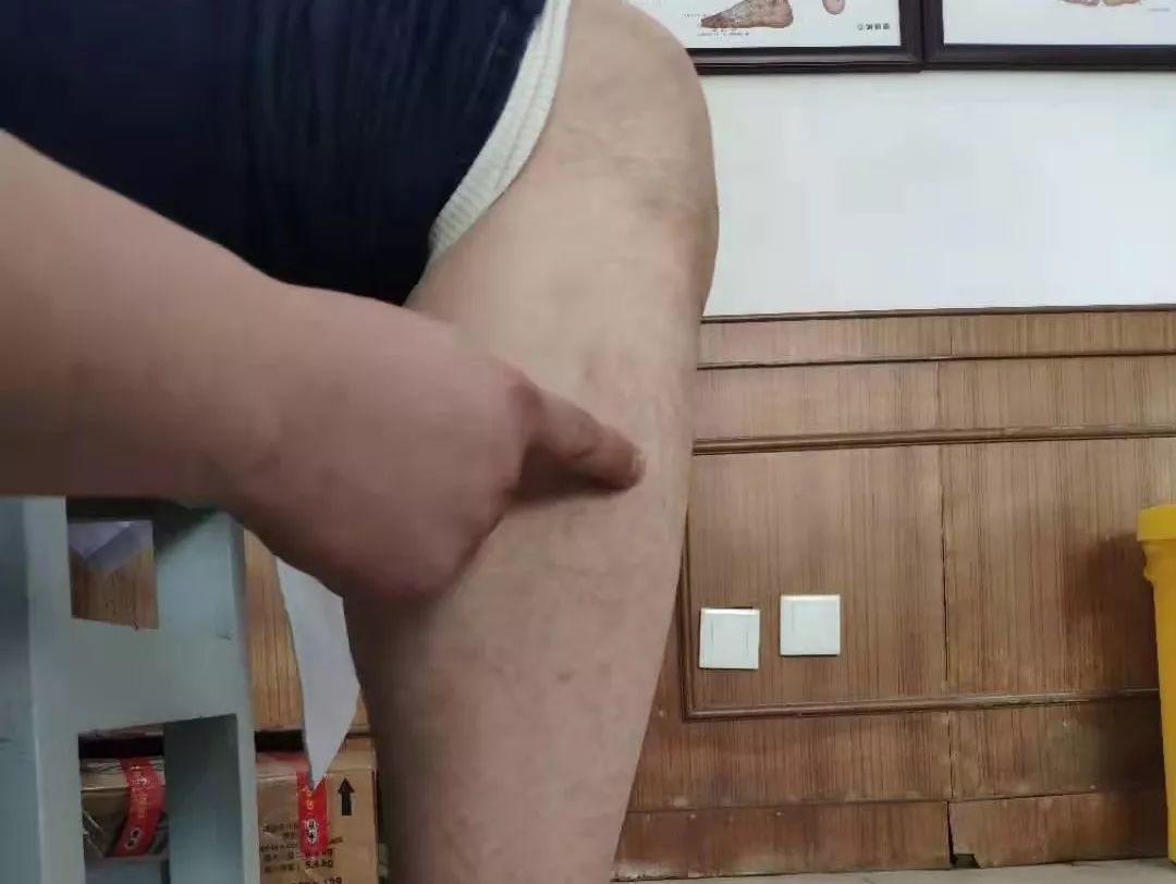 怎样帮中风的人做康复训练视频,如何解决中风后遗症问题