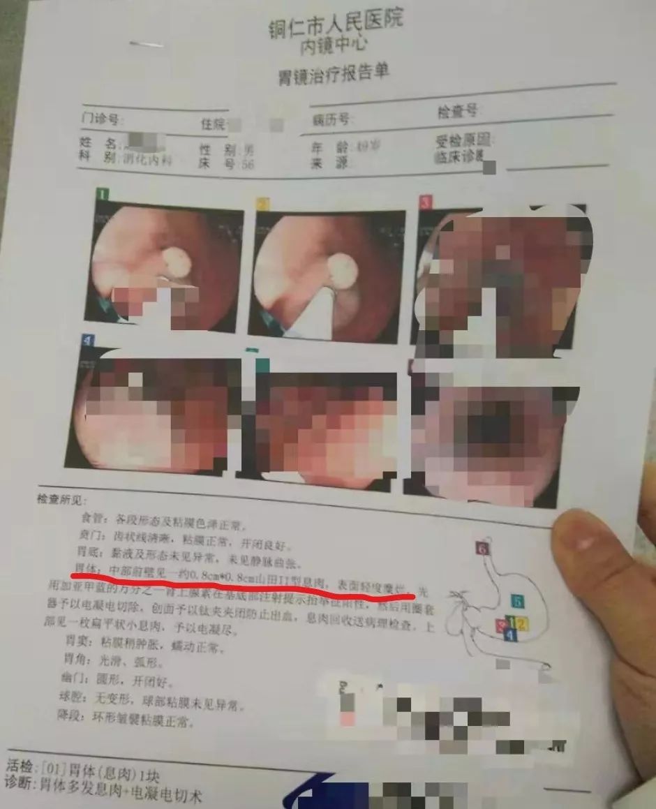 经常吃得太饱肚子会不会大,经常吃得太饱吃坏脾胃