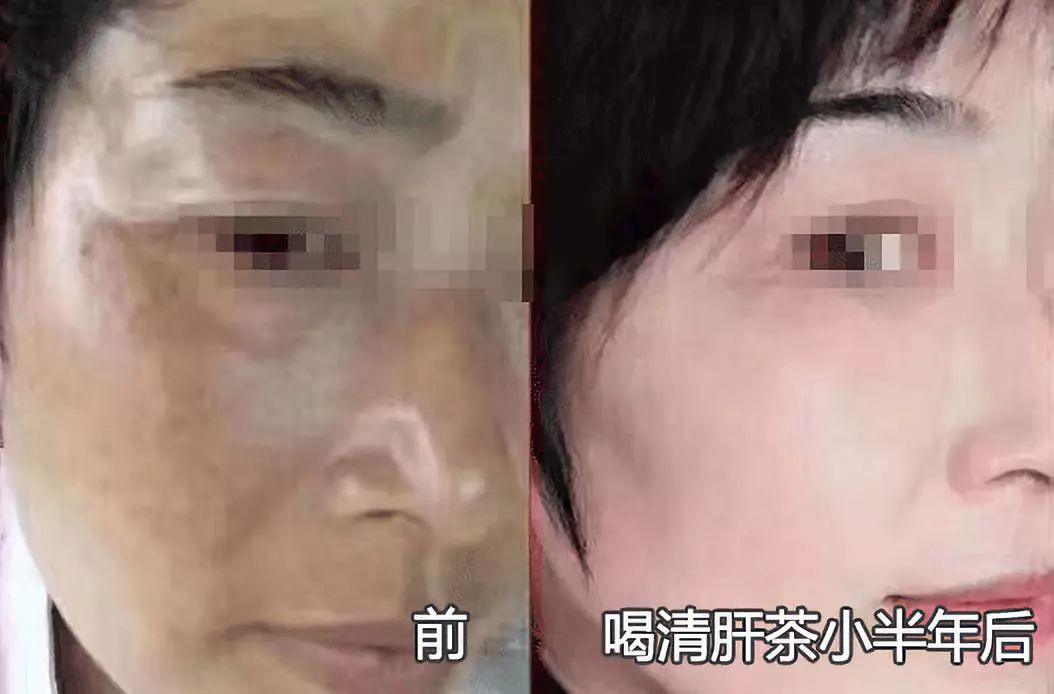 小心肝护肝茶有用吗,小心肝茶叶是什么茶