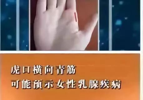 为什么手下垂手背上青筋暴露出来,手血管突出青筋暴起是什么原因