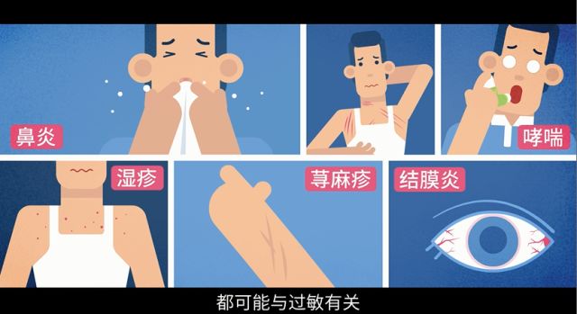 过敏也要科学预防科学治疗,过敏千万别大意