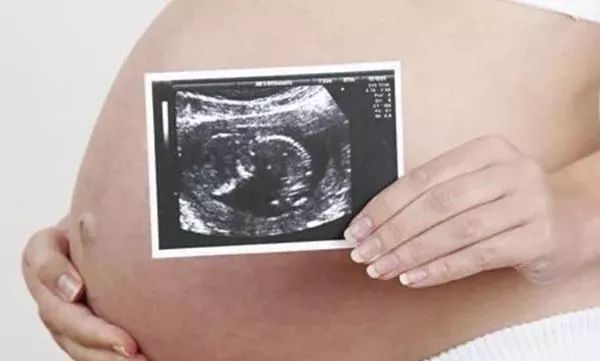 医院超声科新引进设备宣传,营口市中心医院分院彩超室