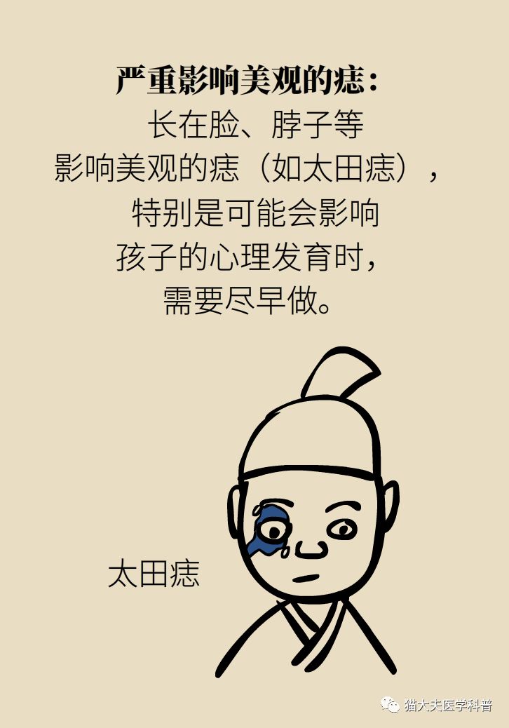 什么症状表明痣已经在恶变,先天性黑素细胞痣恶变的概率大吗