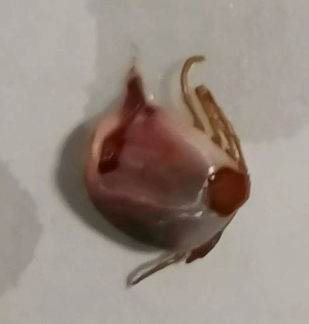 3岁女童头部发痒,3岁孩子突然头痒头皮都抓破了