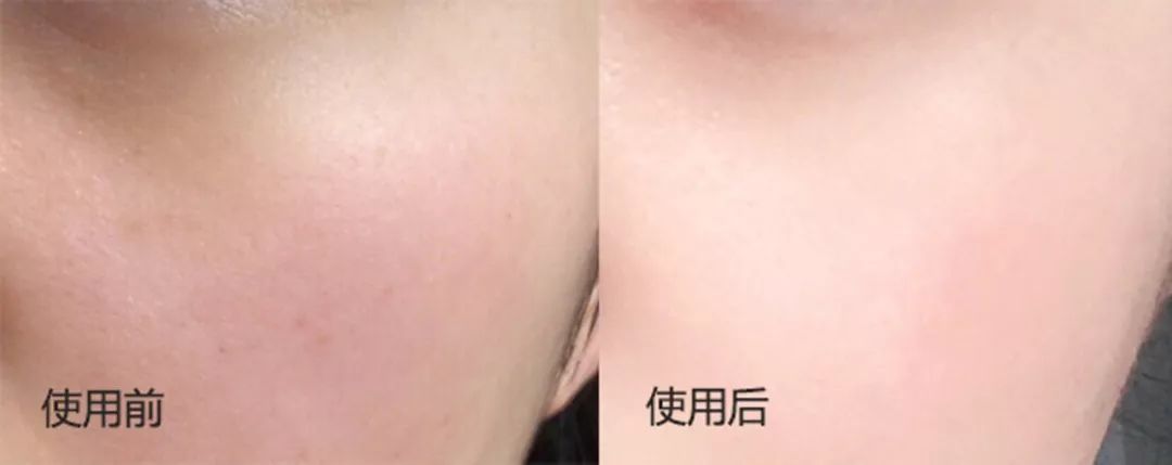 媲美大牌的平价面霜，不到一个月让我白了两度，连斑都看不见了！