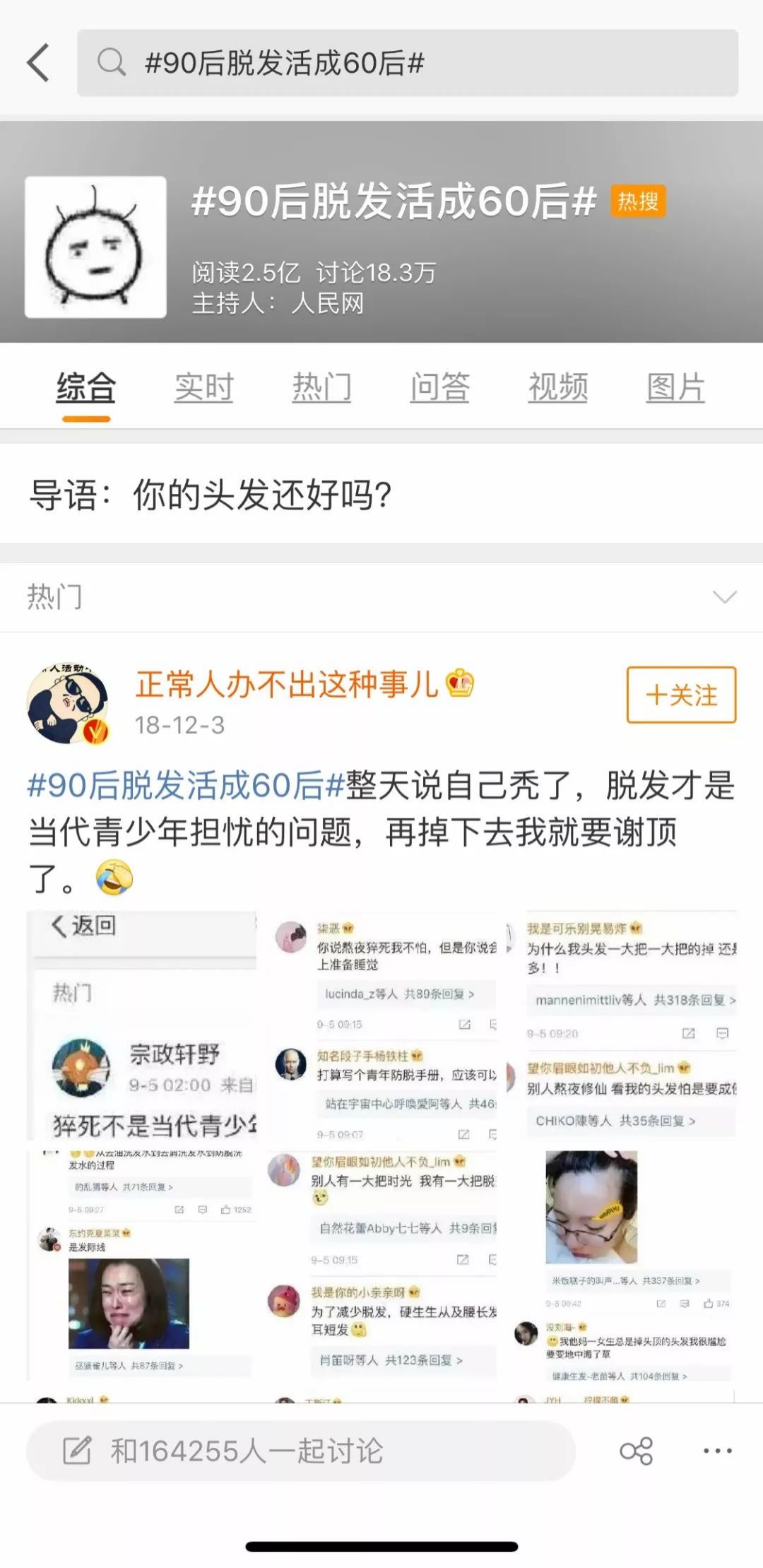 生发长头发神器,脱发生发最新科技