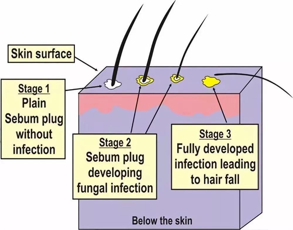 新西兰深度睡眠喷雾,新西兰深睡眠喷雾