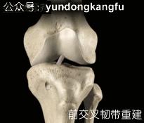 膝腓侧副韧带损伤怎么恢复,膝内侧副韧带损伤修复视频