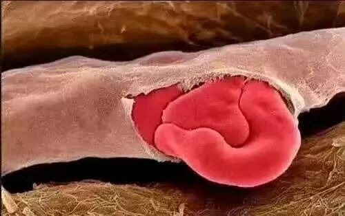 六大激光美容项目注意事项