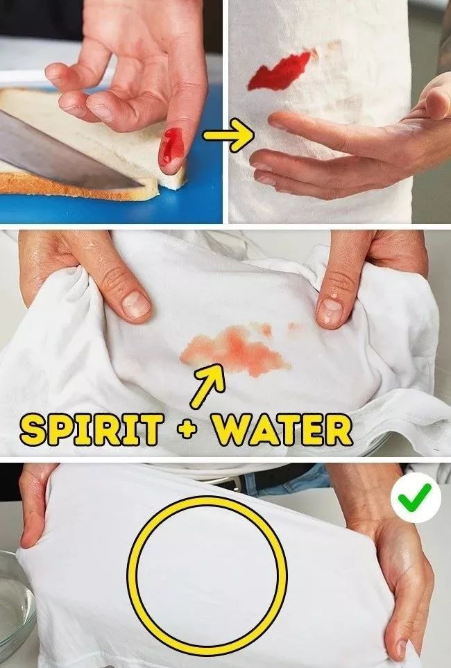 衣服发黄用什么漂白剂比较好,用漂白剂把白色衣服漂黄了怎么办