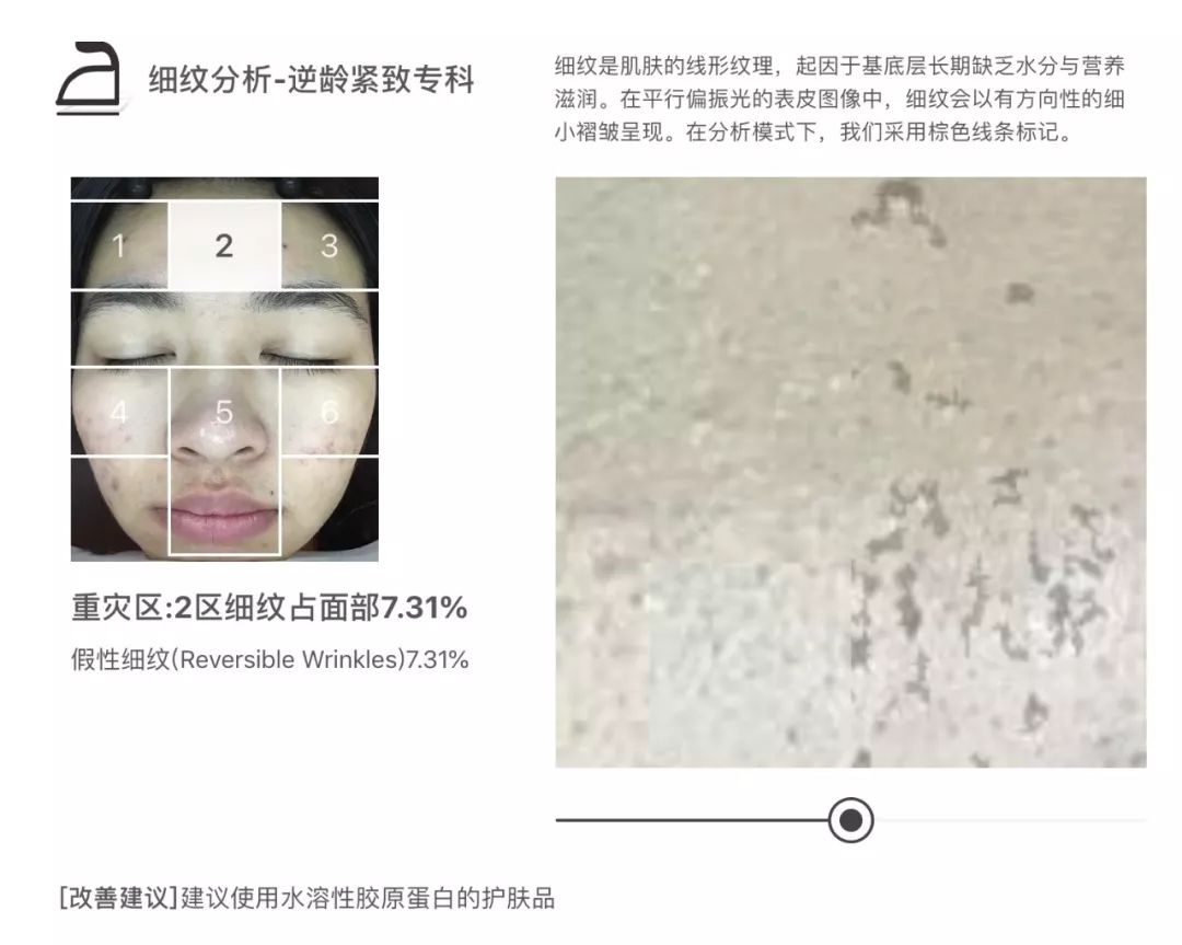 灏忚寕鑲岃瘖瀹ゅ埌搴曟湁澶氬己,灏忚寕鑲岃瘖瀹よˉ姘村悧