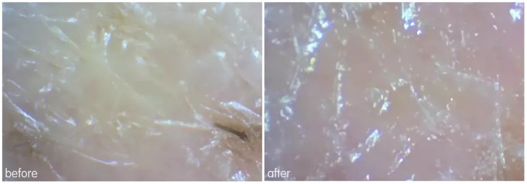 灏忚寕鑲岃瘖瀹ゅ埌搴曟湁澶氬己,灏忚寕鑲岃瘖瀹よˉ姘村悧