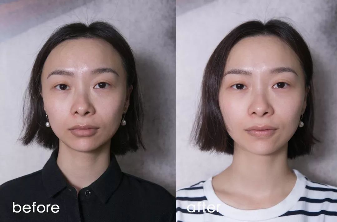 小茂肌诊室∣为什么拼命补水好多年,皮肤还是没变好?