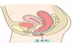 生孩子到底怎么用力才正确,生娃前要怎么放松