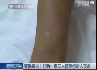 孩子7岁突然眼皮长了个黑点,2岁小孩眼睛上突然长了一颗黑痣