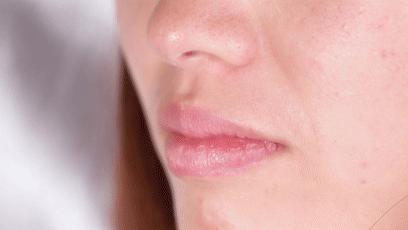 不起眼的乳膏有哪些,药店有一种不起眼的乳膏