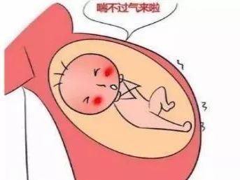 鍓栧浜ц繕鏄『浜у鏄撳ぇ鍑鸿,鍓栧浜т笌椤轰骇瀵瑰瓡濡堢殑鍗卞