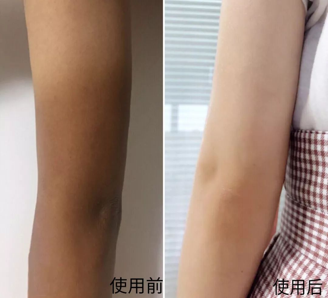 这才是夏天的光腿神器,可以遮腿毛的光腿神器