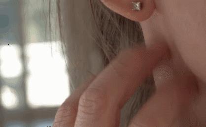 可美金箔祛痘螨虫皂,除螨皂能祛螨虫吗