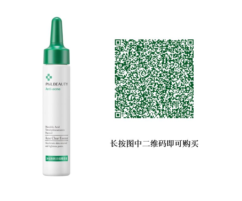 要你好看|听过很多祛痘方法,却还是收拾不了“车祸脸”?