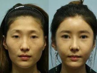 你是亲和脸还是冷淡脸？别乱装可爱了啦！