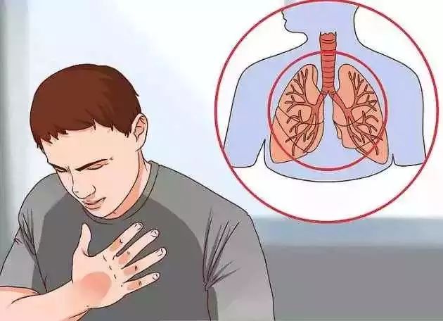 健康科普比赛胸痛,胸痛防控科普