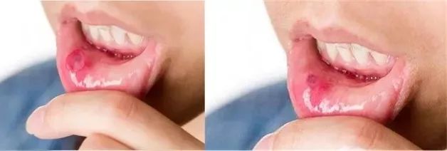 口腔喷雾杀菌除口臭持久留香,睡前口腔喷雾防口臭