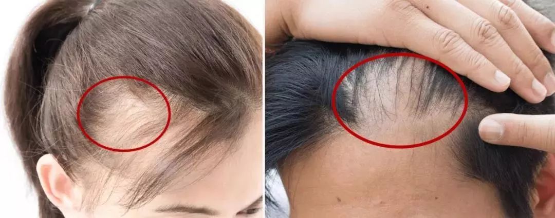 蓬松神器让头发立马蓬松,头发蓬松神器顶发根