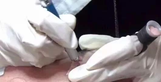 纹眉颜色太深了可以用遮瑕膏么,纹眉太深用土黄色可以吗