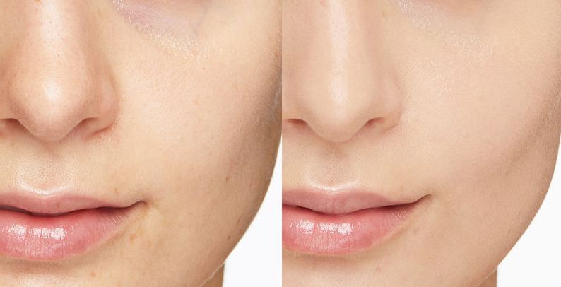 李佳琦OMG的夏日气垫,你买不买