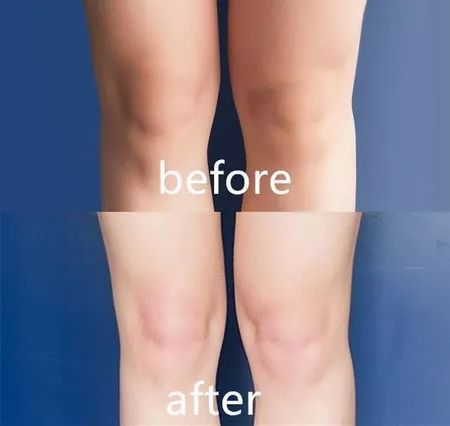 现在流行像林允一样给全身化妆，再也不愁脸太小化妆品都用不完了