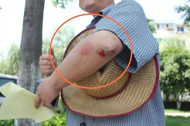 8厘米?女司机连撞3车伤1人!又是它惹的祸!