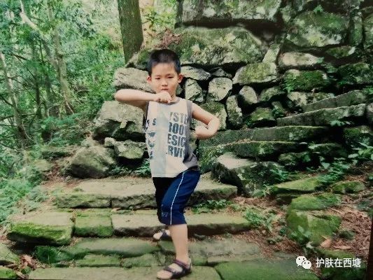 白色花斑糠疹,白色糠疹需要与哪些疾病相鉴别