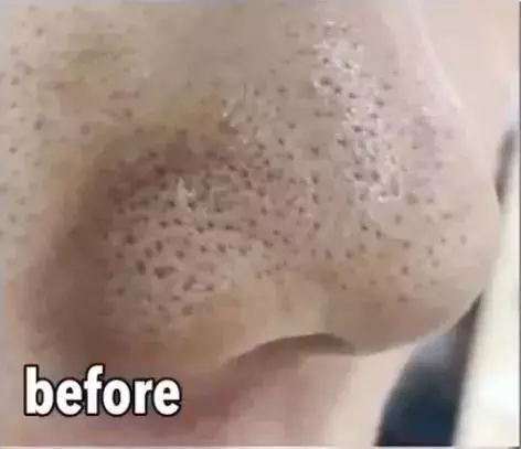 10块钱以内的护肤品都有什么,10块钱护肤好东西