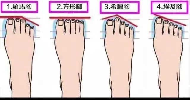 罗马脚埃及脚希腊脚的区别,罗马脚和希腊脚香港脚