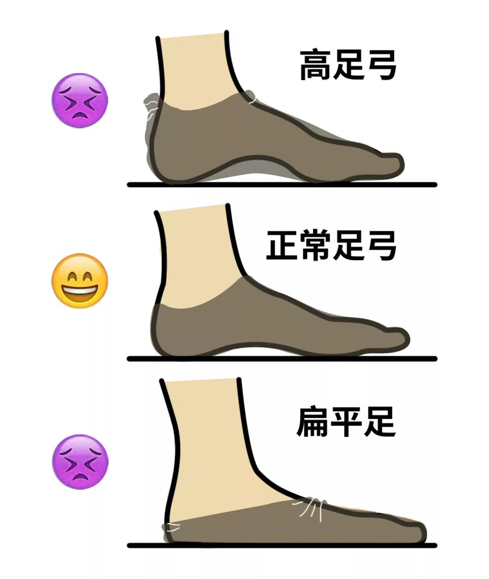 走路掉袜子的科学解决方法,老是掉袜子怎么办小妙招