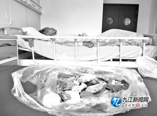 吃医院开的中药导致肝衰竭怎么办,药物引起的肝衰竭医生要赔钱案例