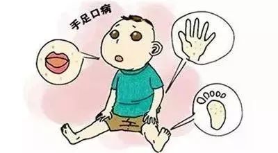 幼儿急疹和手足口病怎么治,手足口急疹荨麻疹同时出现