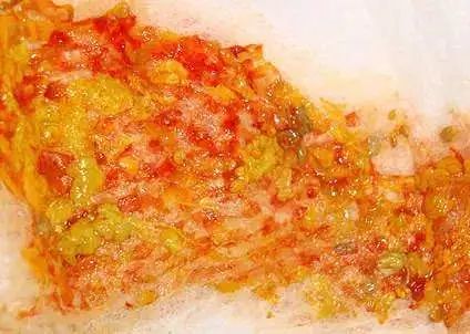 如何辨别宝宝大便颜色是否正常,宝宝所有大便的颜色及症状