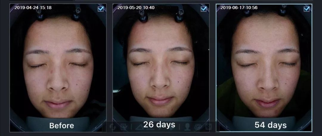 平价精华测评真实推荐,28天精华真实测评