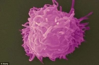 戴隐形眼镜导致角膜内皮细胞减少,因为戴隐形眼镜眼睛肿了