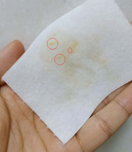 去黑头鼻贴推荐黑头导出液,去黑头的最好办法告别草莓鼻