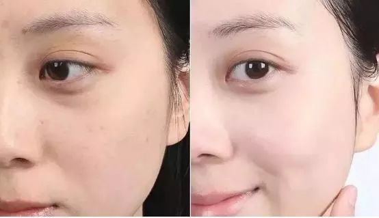 柔嫩抛光|脸上搓出3斤泥!难怪又黄又暗又黑头!10秒给脸蛋“剥壳”,厉害