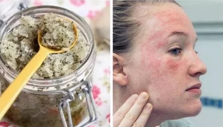 脸上搓下来很多泥,脸上搓出黑头