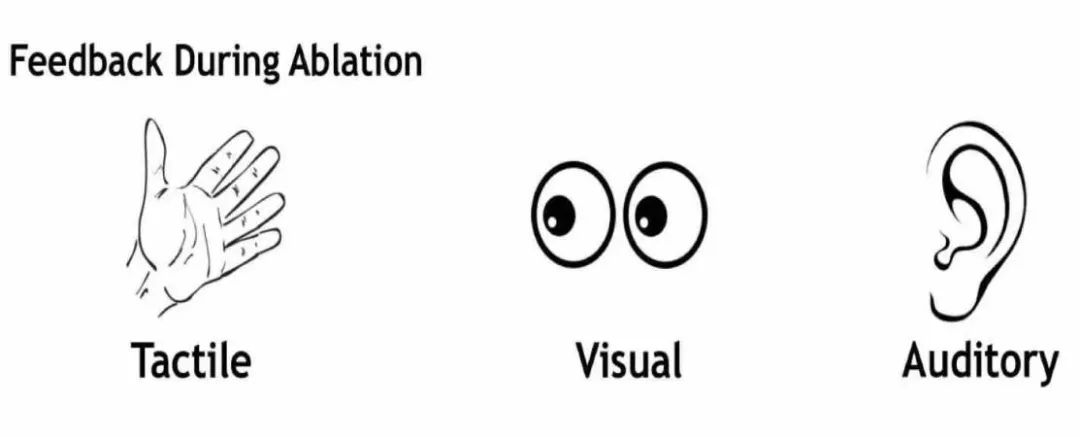 旋磨可以消除钙化吗,准分子激光冠脉钙化斑块消融术
