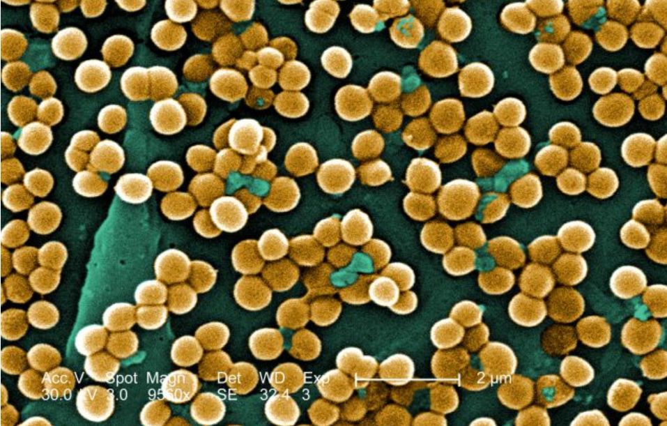 金色葡萄球菌感染会死吗,金色葡萄球菌感染有危险吗