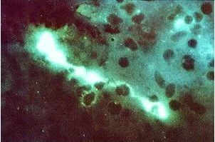 鸟屎为什么是白色的,鸟屎为什么有各种颜色