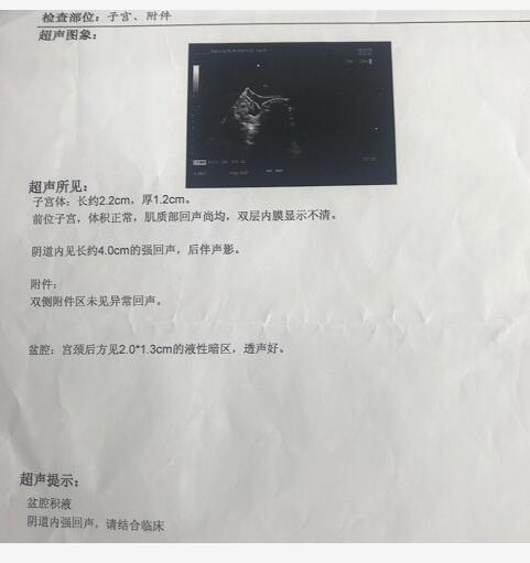 女童下身流脓四年，原来里面塞了果肉