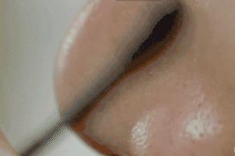 鸡蛋清除黑头,快速物理去黑头