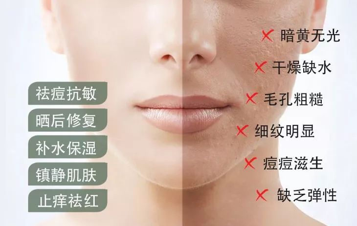 芦荟胶补水保湿提亮肤色晒后修复,祛痘晒后修复保湿补水芦荟胶